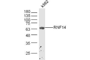 Image no. 1 for anti-ADAM Metallopeptidase Domain 2 (ADAM2) (AA 451-550) antibody (ABIN5675446)