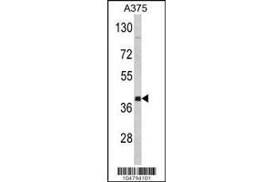 Image no. 2 for anti-Farnesyltransferase, CAAX Box, alpha (FNTA) (AA 330-360), (C-Term) antibody (ABIN1882083)