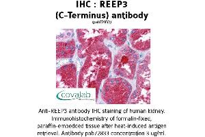 Image no. 1 for anti-Receptor Accessory Protein 3 (REEP3) (C-Term) antibody (ABIN1738796)