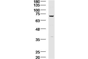 Image no. 1 for anti-Sphingomyelin phosphodiesterase 1, Acid Lysosomal (SMPD1) antibody (ABIN873109)
