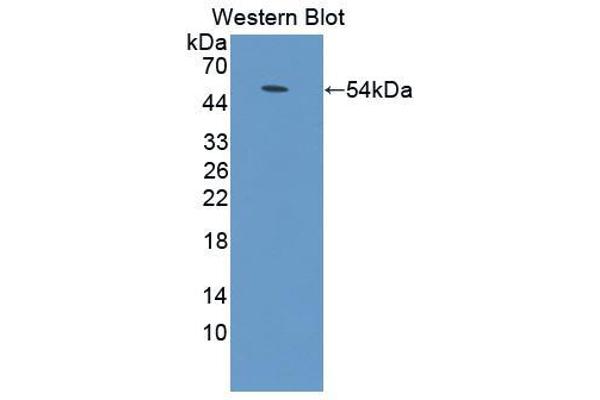 anti-Adenylate Cyclase 9 (ADCY9) (AA 852-1065) antibody