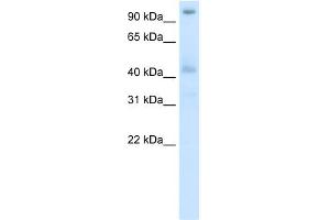 Image no. 1 for anti-Pogo Transposable Element with ZNF Domain (POGZ) (N-Term) antibody (ABIN2780963)