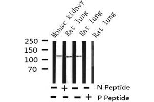Image no. 6 for anti-PTK2 Protein tyrosine Kinase 2 (PTK2) (pTyr397) antibody (ABIN6256730)