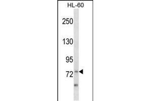 ZBTB39 Antibody (Center) (ABIN1538134 and ABIN2849854) western blot analysis in HL-60 cell line lysates (35 μg/lane).