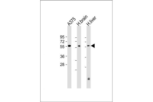 DLL3 antibody  (C-Term)