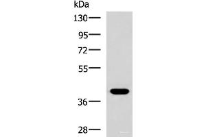 Western blot analysis of HepG2 cell lysate using PLPPR5 Polyclonal Antibody at dilution of 1:1500