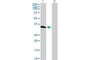Image no. 1 for anti-Methyltransferase Like 2B (METTL2B) (AA 1-313) antibody (ABIN527685)