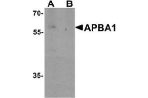Image no. 1 for anti-Amyloid beta (A4) Precursor Protein-Binding, Family A, Member 1 (APBA1) (N-Term) antibody (ABIN1450013)