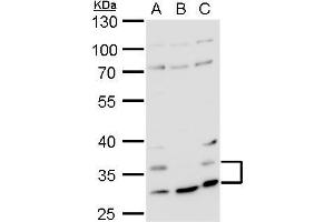 WB Image Histamine H4 Receptor antibody detects Histamine H4 Receptor protein by western blot analysis.
