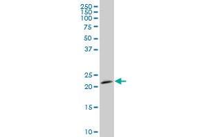 STMN2 monoclonal antibody (M06), clone 2G11 Western Blot analysis of STMN2 expression in IMR-32 .