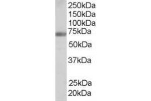 Image no. 2 for anti-Formin Binding Protein 1 (FNBP1) (Internal Region) antibody (ABIN185286)