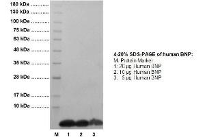 Image no. 1 for Brain Natriuretic Peptide (BNP) protein (ABIN593365)