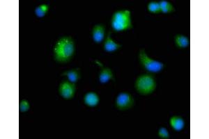 Immunofluorescence staining of MCF-7 cells with ABIN7164840 at 1:166, counter-stained with DAPI.