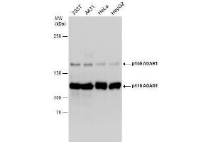 Image no. 3 for anti-Adenosine Deaminase, RNA-Specific (ADAR) (Internal Region) antibody (ABIN2855100)