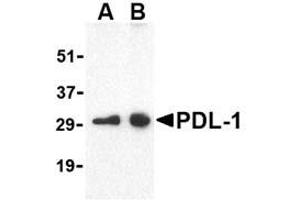 Image no. 3 for anti-CD274 (PD-L1) (Internal Region) antibody (ABIN6656633)