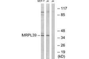 anti-Mitochondrial Ribosomal Protein L39 (MRPL39) (AA 289-338) antibody