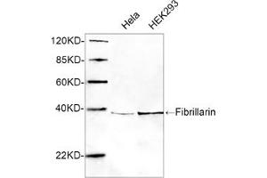 Image no. 1 for anti-Fibrillarin (FBL) (AA 50-100) antibody (ABIN1574130)