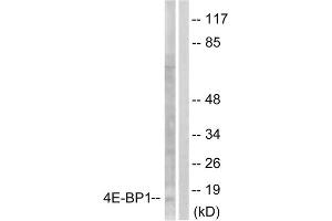 Image no. 3 for anti-Eukaryotic Translation Initiation Factor 4E Binding Protein 1 (EIF4EBP1) (Ser65) antibody (ABIN1847928)