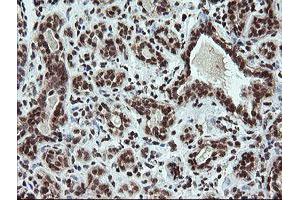 Image no. 14 for anti-Fetal and Adult Testis Expressed 1 (FATE1) antibody (ABIN1498222)