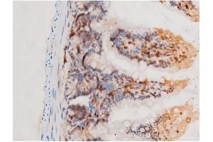 Image no. 9 for anti-Spleen tyrosine Kinase (SYK) (pTyr525) antibody (ABIN6255944)