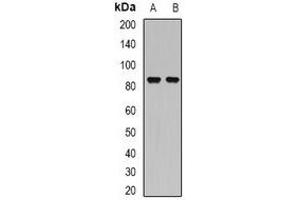 Image no. 3 for anti-Structure Specific Recognition Protein 1 (SSRP1) antibody (ABIN2967065)