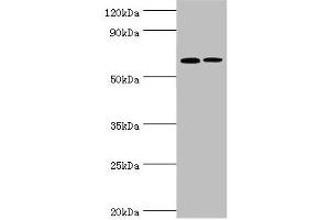IL27 Receptor alpha antibody  (AA 33-283)