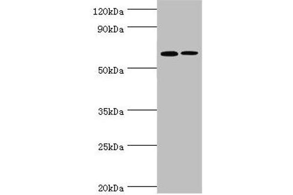 IL27 Receptor alpha Antikörper  (AA 33-283)