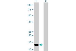 Image no. 2 for anti-FK506 Binding Protein 1A, 12kDa (FKBP1A) (AA 1-108) antibody (ABIN560904)