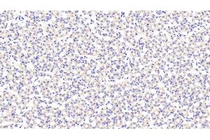 Biglycan antibody  (AA 53-166)