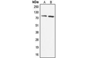 Image no. 3 for anti-Coenzyme Q8A (COQ8A) (Center) antibody (ABIN2705635)