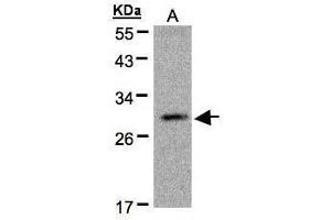 WB Image Sample(30 μg of whole cell lysate) A:MOLT4, 12% SDS PAGE antibody diluted at 1:500
