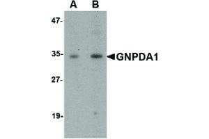 Image no. 1 for anti-Glucosamine-6-Phosphate Deaminase 1 (GNPDA1) (C-Term) antibody (ABIN6656718)