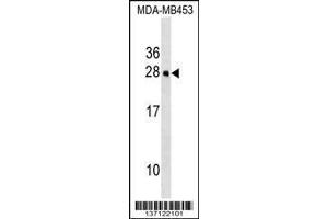 Image no. 1 for anti-Homeobox C5 (HOXC5) (AA 140-167), (C-Term) antibody (ABIN1536714)
