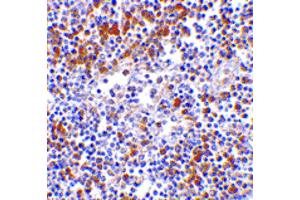 Image no. 1 for anti-Interferon Induced with Helicase C Domain 1 (IFIH1) (C-Term) antibody (ABIN6655946)