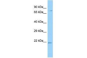 FUNDC2 Antikörper  (N-Term)