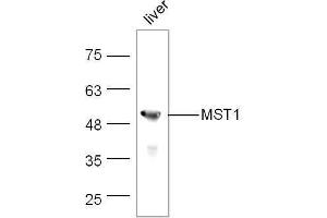 anti-Macrophage Stimulating 1 (Hepatocyte Growth Factor-Like) (MST1) (AA 385-487) antibody
