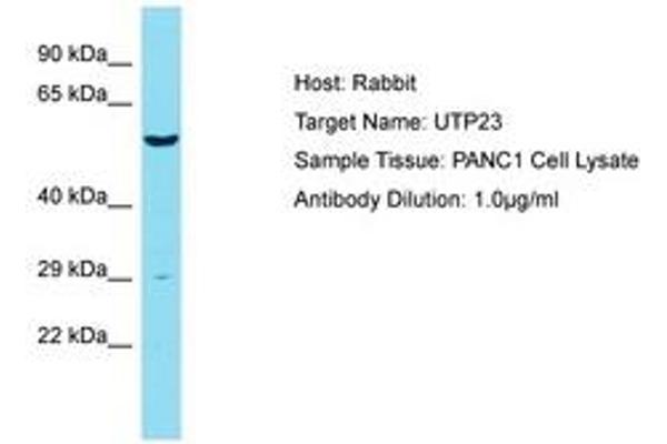 UTP23 抗体  (AA 151-200)