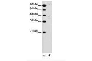 Image no. 1 for anti-Chemokine Binding Protein 2 (CCBP2) (N-Term) antibody (ABIN6736593)