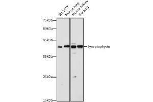 Synaptophysin Antikörper  (AA 150-250)