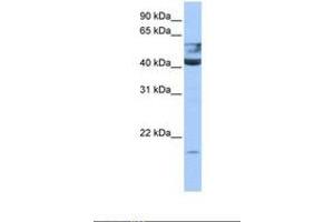 Image no. 1 for anti-Queuine tRNA-Ribosyltransferase 1 (QTRT1) (AA 45-94) antibody (ABIN6738529)