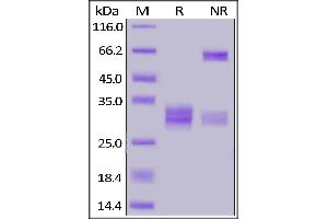 Image no. 3 for CD8 (CD8) (AA 22-182) (Active) protein (His tag) (ABIN7013442)