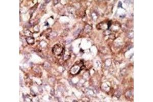 Image no. 4 for anti-BCL2-Associated Agonist of Cell Death (BAD) (AA 92-127) antibody (ABIN3030135)