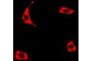Image no. 1 for anti-Transcobalamin I (Vitamin B12 Binding Protein, R Binder Family) (TCN1) (full length) antibody (ABIN6004316)
