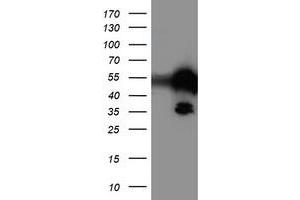 Image no. 1 for anti-T-Cell Acute Lymphocytic Leukemia 1 (TAL1) antibody (ABIN1501289)