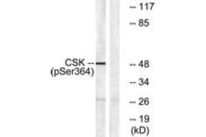 Western blot analysis of extracts from HeLa cells treated with PMA 125ng/ml 30', using Csk (Phospho-Ser364) Antibody.