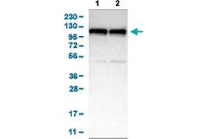 Image no. 3 for anti-ATP-Binding Cassette, Sub-Family F (GCN20), Member 1 (ABCF1) (AA 85-196) antibody (ABIN5774372)