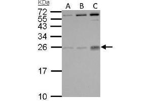 WB Image PLGF antibody detects PGF protein by Western blot analysis.