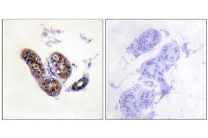 Image no. 3 for anti-Microphthalmia-Associated Transcription Factor (MITF) (Ser180), (Ser73) antibody (ABIN1847958)