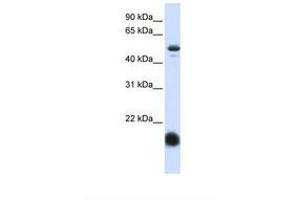 Image no. 1 for anti-Solute Carrier Family 22 (Organic Cation Transporter), Member 7 (SLC22A7) (AA 72-121) antibody (ABIN6738027)