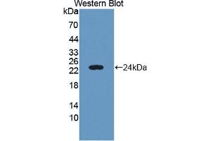 Image no. 1 for anti-Chromosome 6 Open Reading Frame 150 (C6orf150) (AA 225-407) antibody (ABIN5013901)